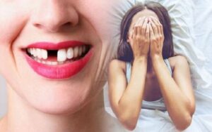 Giải mã giấc mơ thấy gãy răng